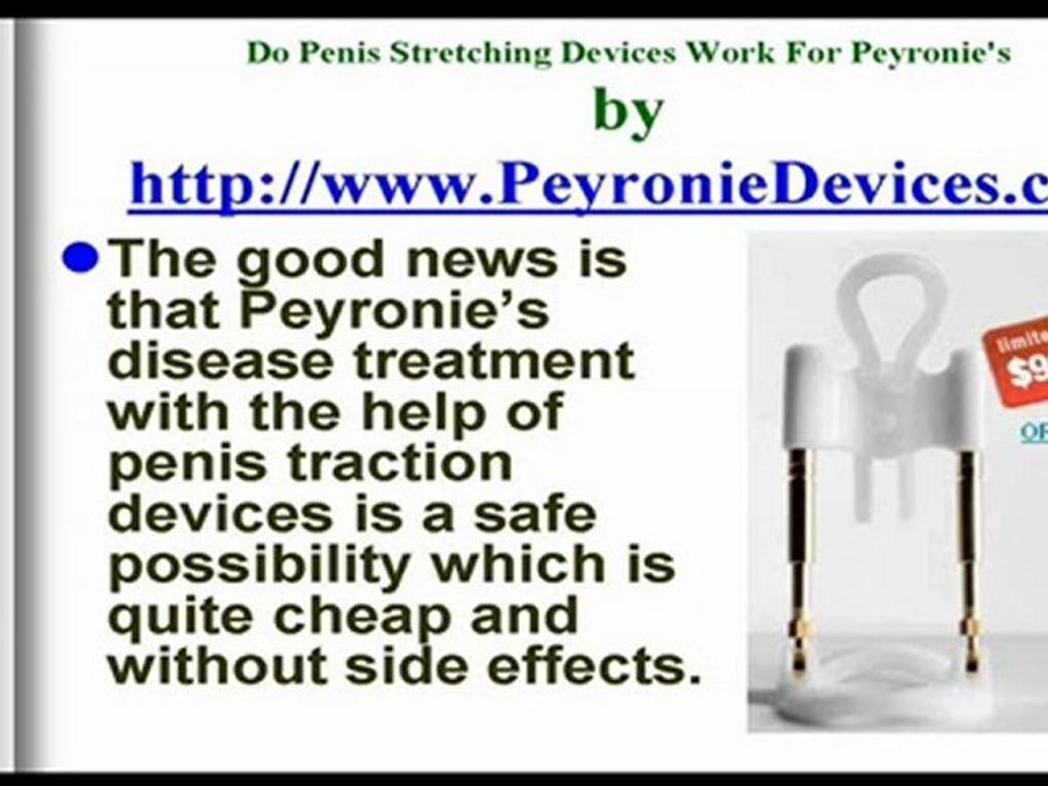 Do Penile Stretching Devices Work For Peyronie's? video Dailymotion