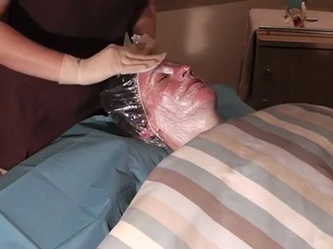 Collagen Stimulation TherapyDerma Roller