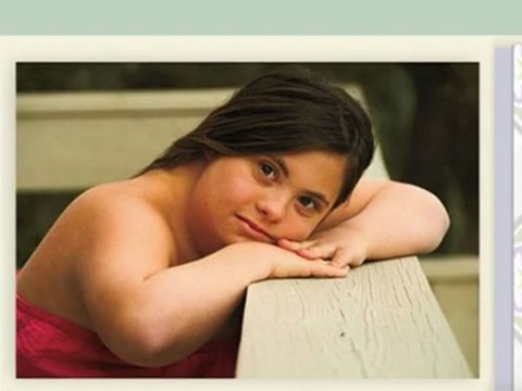 Down Syndrome Help - Down Syndrome Facts and Its Definition