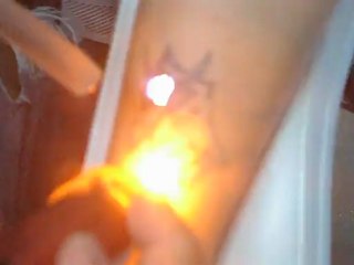 lazerle dövme silme