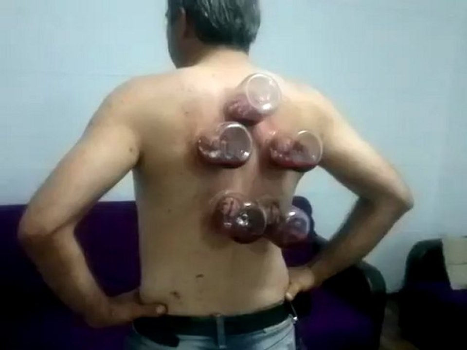 +18 hacamat