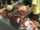 قتلى وجرحى برصاص الأمن اليمني