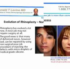 Nose job is more than cosmetic surgery