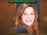 Encino cosmetic dentist, Beverly Hills Dental Veneers Smile Studio LA Call Now 818-906-4238