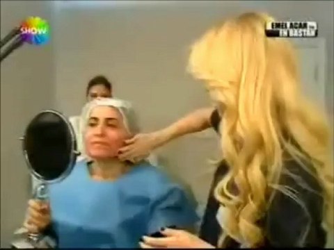 lazerle cilt gençleştirme