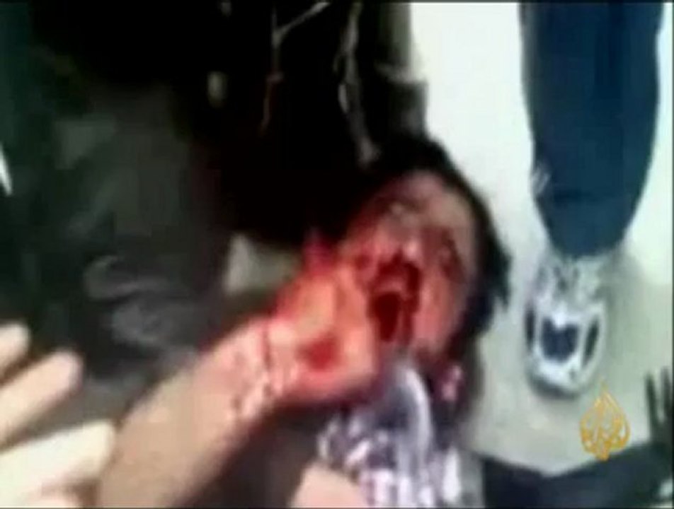 مأساة جرحى الثورة السورية