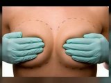 Alabama Plastic Surgeon | Tuscaloosa, Fayette, Birmingham