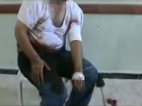 Syria فري برس حلب أصابة عقيد وأسره وقتل عقيد ومقدم ريف حلب 2012 7 22 Aleppo