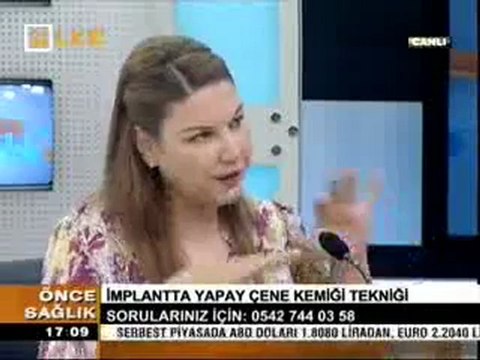 implantta Yapay Çene Kemiği Tekniği Nedir?