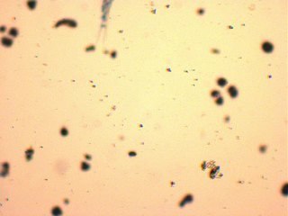 Ruderfußkrebs auf Drogen? Das erstaunliche Verhalten des krassen Meeresbewohners 🦀