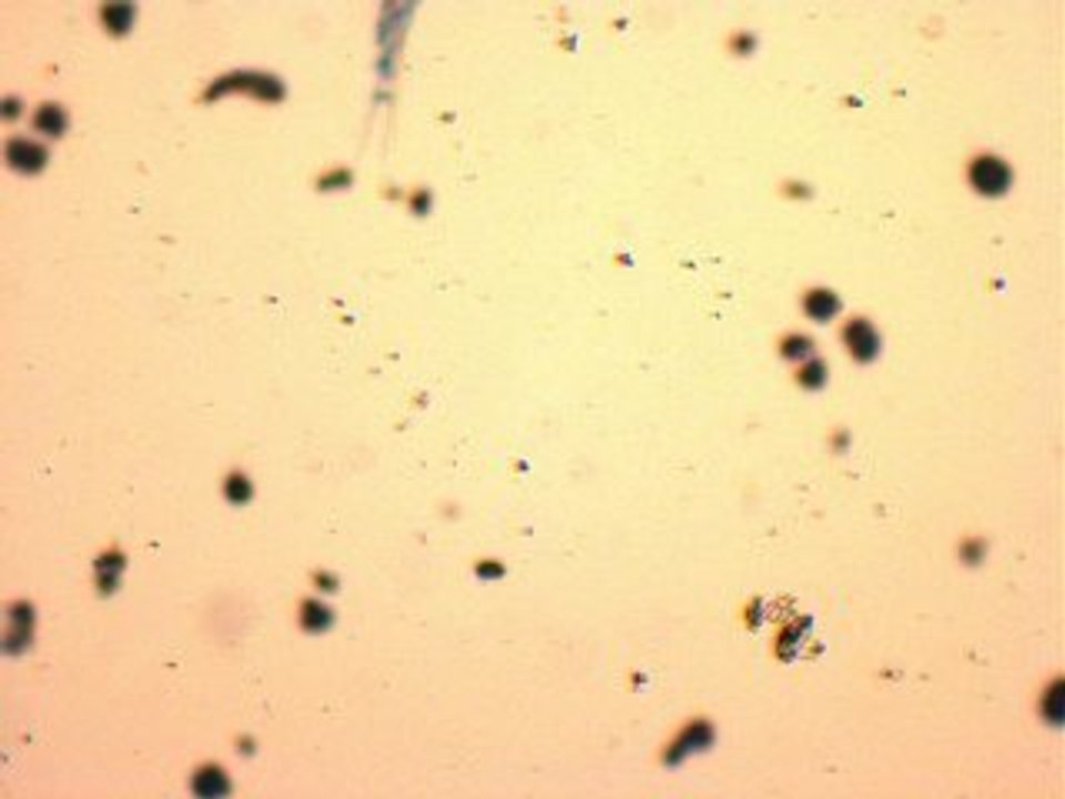 Ruderfußkrebs auf Drogen