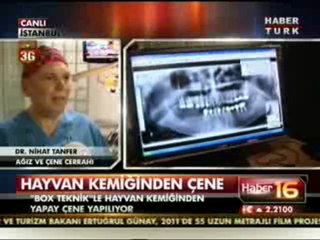 Hayvan Kemiğinden Çene Yapımı Box Teknik Uygulaması Nedir?