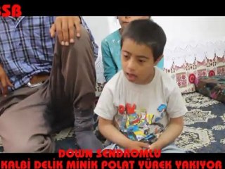 KALBİ DELİK MİNİK POLAT YÜREK YAKIYOR