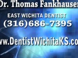 Cosmetic Dentist Wichita KS, Dental Veneer vs. Lumineer, Procelain Veneers 67206, Dentist Mcconnell, Dr. Fankhauser