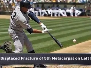 When to Expect Alex Rodriguez to Return