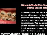 Dental Treatments India, Dental Care Services India, Dental Hospital Kochi