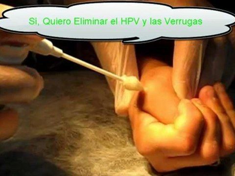 Verrugas Genitales en Mujeres Virus HPV