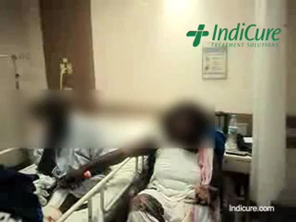 Minimally Invasive Total Knee Replacement Surgery at Affordable cost in India