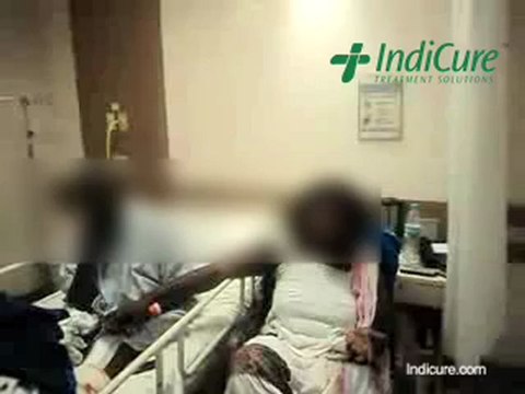 Minimally Invasive Total Knee Replacement Surgery at Affordable cost in India