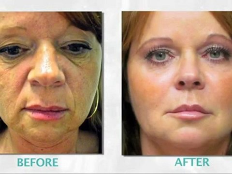 Vitality Medical Laser & Skin Clinic Treatments