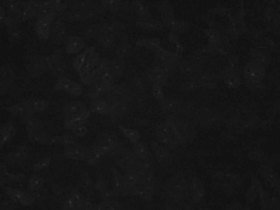 April 19 Development GFP tubulin