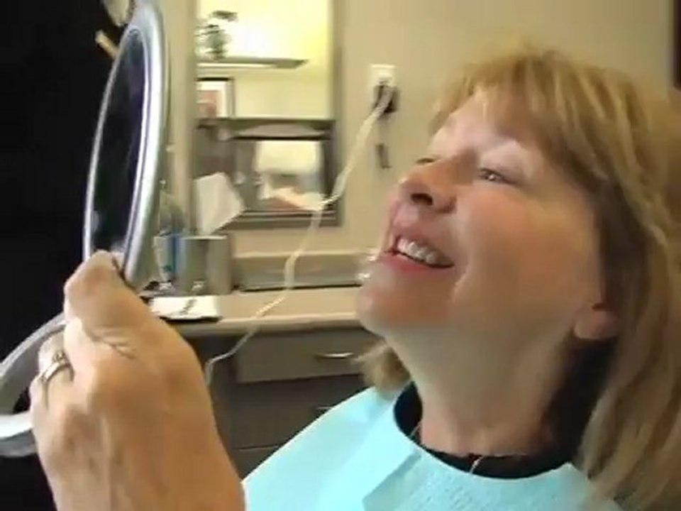 Teeth Whitening  in Atlanta by Dr. Hugh Flax
