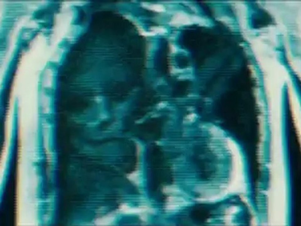 The Possession - Trailer