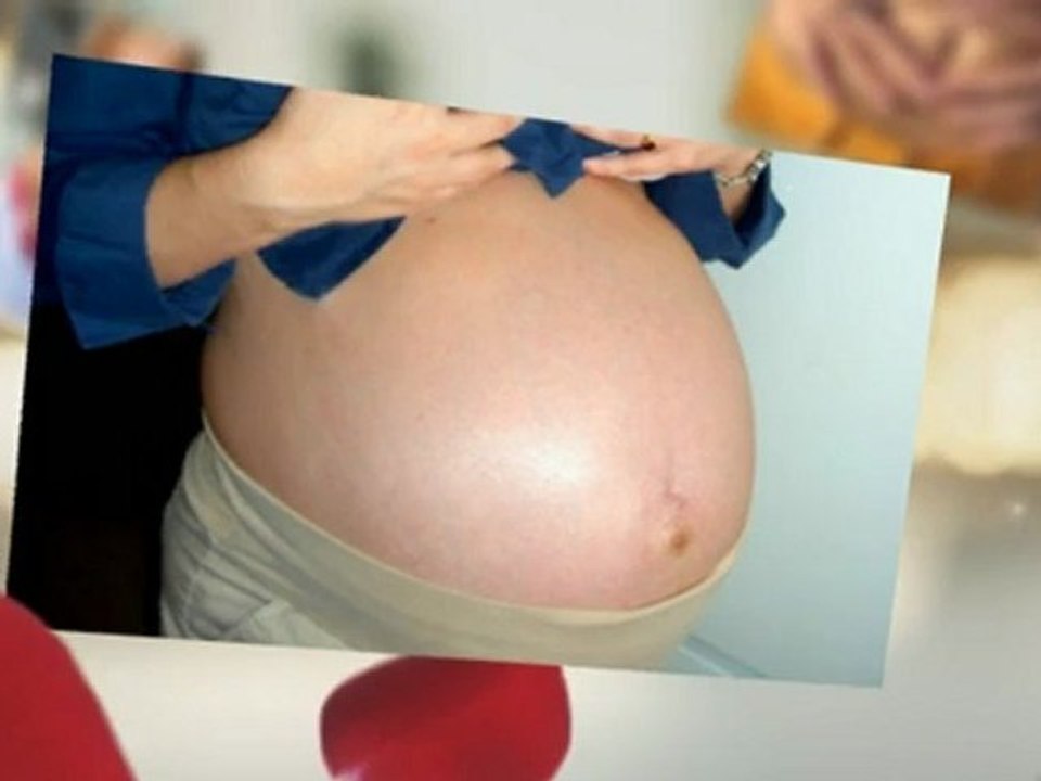 Effective Stretch Mark Remover Strategies Which You Can Utilize
