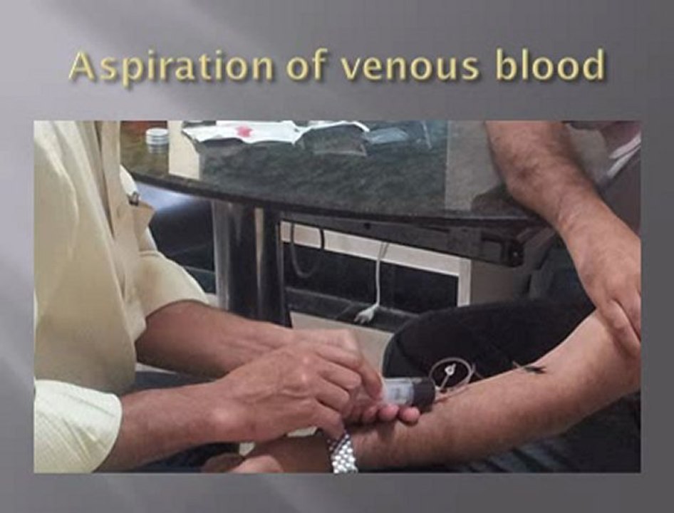 Platelet Rich Plasma injection
