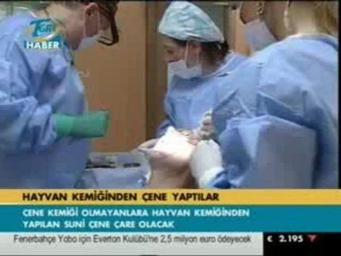 Hayvan Kemiğinden Çene Nasıl Yapılır?