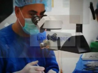 How do I find a LASIK surgeon