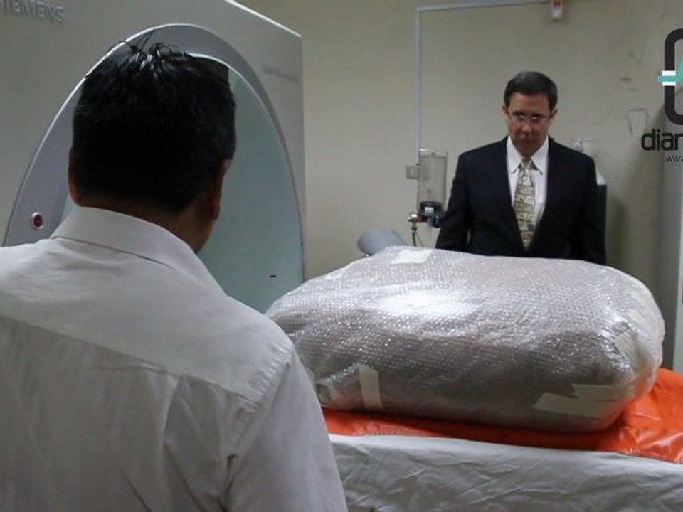 Estudio de Aterosclerosis en Hospital Mogrovejo promovido por SIEMENS