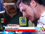 Lesionado a golpes (Fuertes Imagenes) (Drunk Fights)