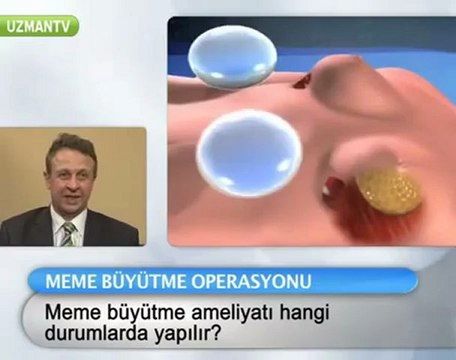 Meme Büyütme Ameliyatı Hangi Durumlarda Yapılır?
