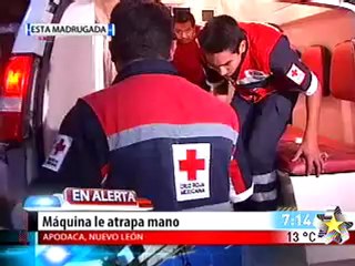 Maquina le atrapa la mano (FUERTES IMAGENES)