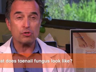 What does toenail fungus look like?