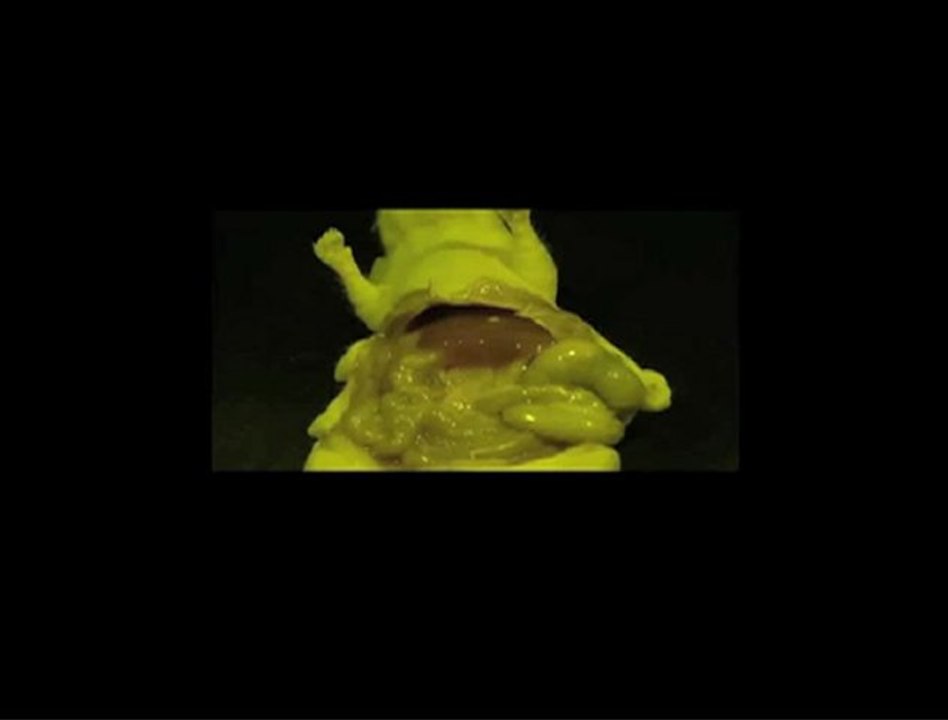 Chirurgie assistée par fluorescence