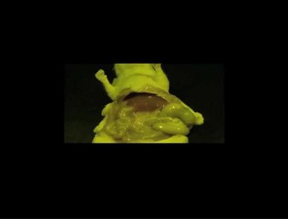 Chirurgie assistée par fluorescence