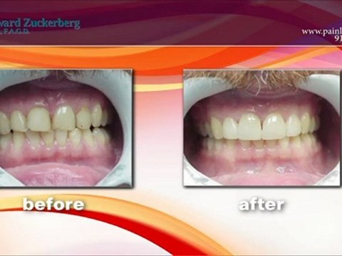 Dobbs Ferry Dentists - Dr. Edward Zuckerberg & Dr. Kevin Jong