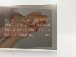 Pain Management Treatment - Long-Term Pain and Its Treatment