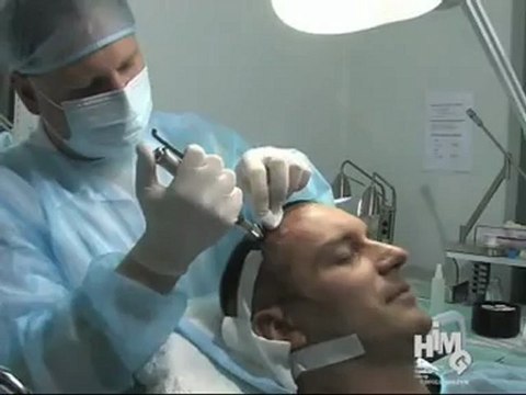 Hajbeültetés - Szebeni István 2 of 3