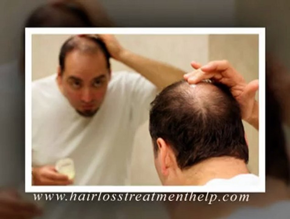 Natural Hair loss treatment for men - Provillus Reviews