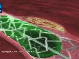 The Izhar Gafni's bike to 10 dollars.