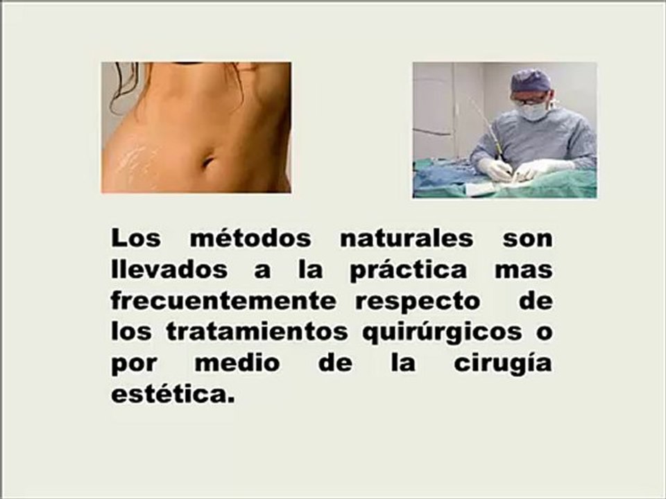 Como Eliminar Las Estrias Rapidamente - como se eliminan las estrias