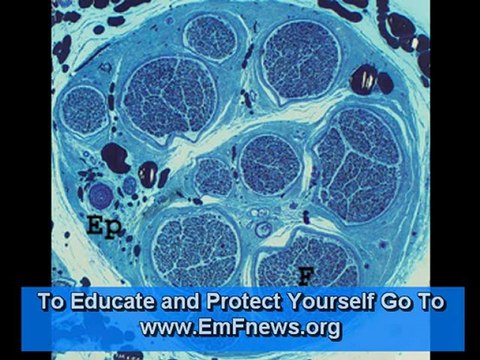 Microwave Radiation Effects (Radiation Meters) Microwave Radiation Effects