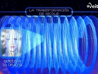La Noche De... - Nicole Kidman y la cirugía