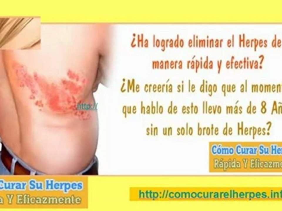 enfermedad herpes - clases de herpes - como eliminar el herpes