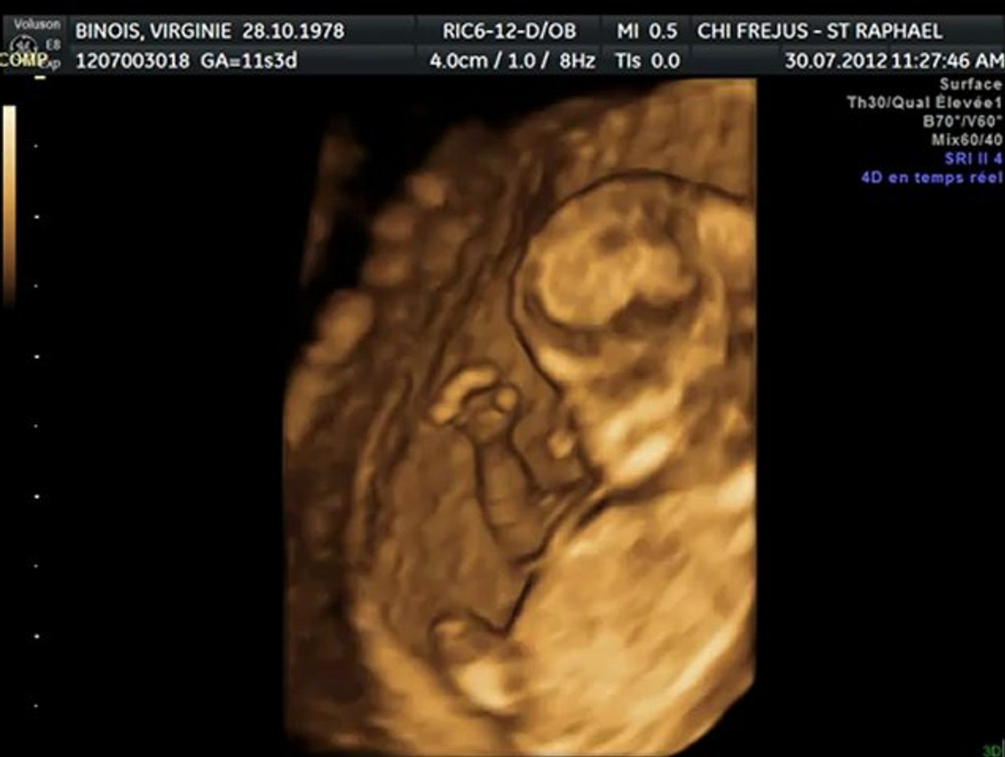 Echo 3d 10sg Video Dailymotion