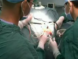 Un motorista chino gravemente herido al clavársele un hierro en la cabeza