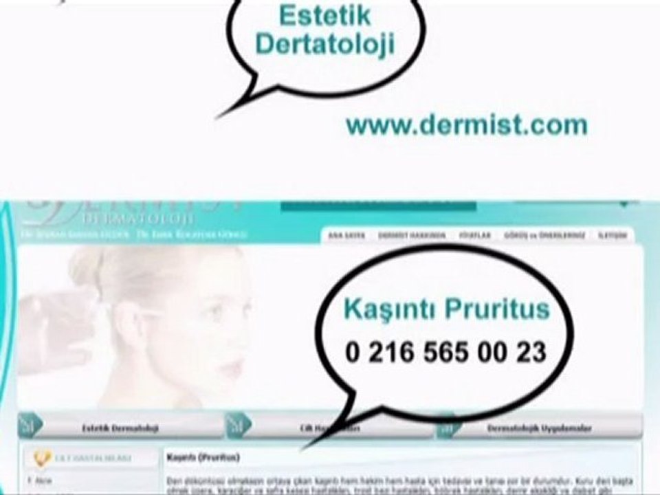 Kasinti Pruritus / www.dermist.com